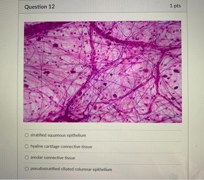 Solved Question Motor Neuron Hyaline Cartilage Connective Chegg