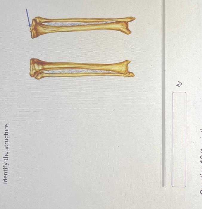 Which Of The Following Are Structure Diagrams