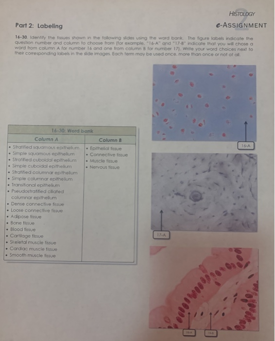 Solved Identify The Tissues Shown In The Following Slides Chegg