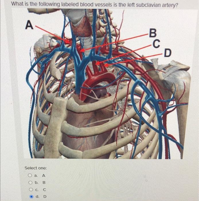 Solved What Is The Following Labeled Blood Vessels Is The Chegg