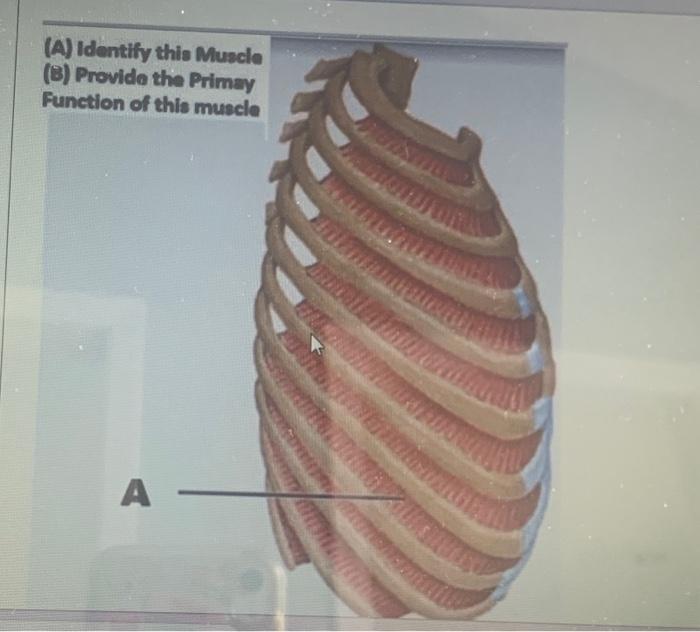 Solved Identify The Structure Indicated By The Arrow Chegg