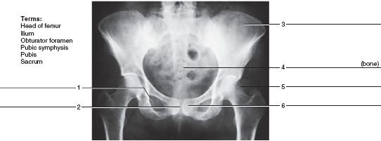 Solved Identify The Bones And Features Indicated In The Radiograp