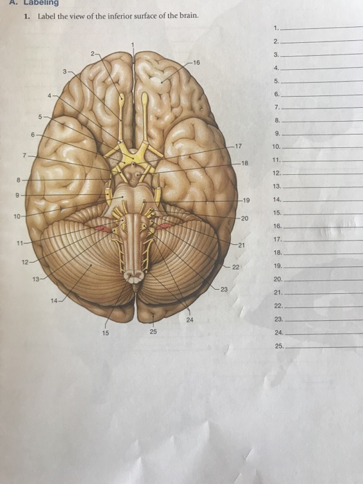 Solved A Labeling 1 Label The View Of The Inferior Surfa