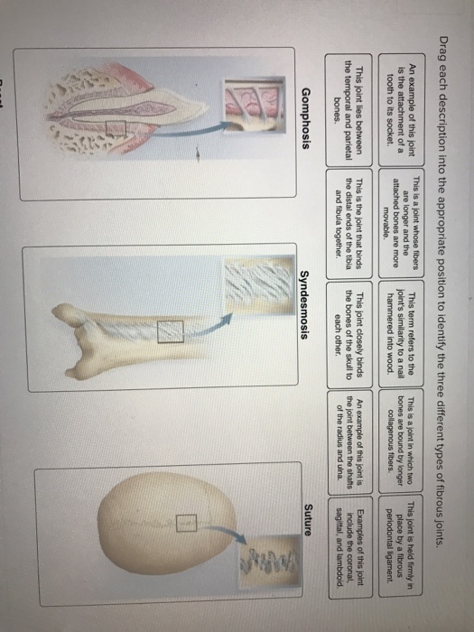 three types of fibrous joints