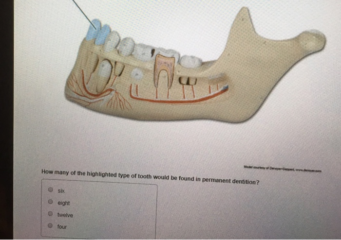 Solved: Which Structure Is Highlighted? О Pulp O Enamel O ... | Chegg.com