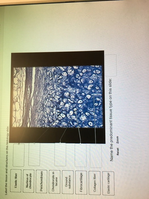 Solved In Name The Predominant Tissue Type On This Slide Chegg Com