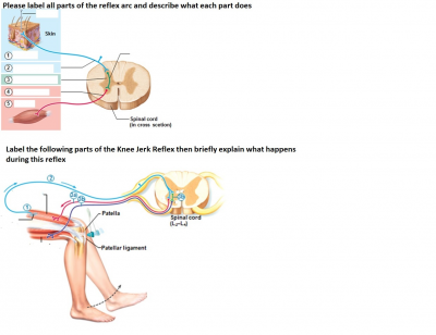 Solved Please Label All Parts Of The Reflex Arc And Describe Chegg Com