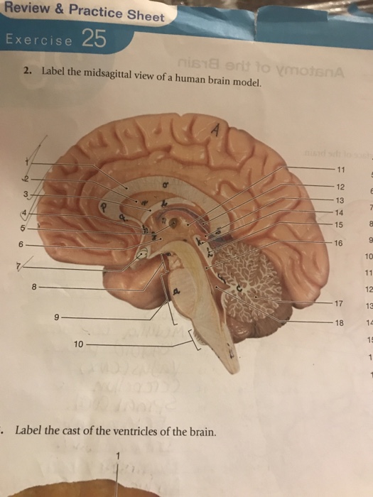 brain midsagittal view