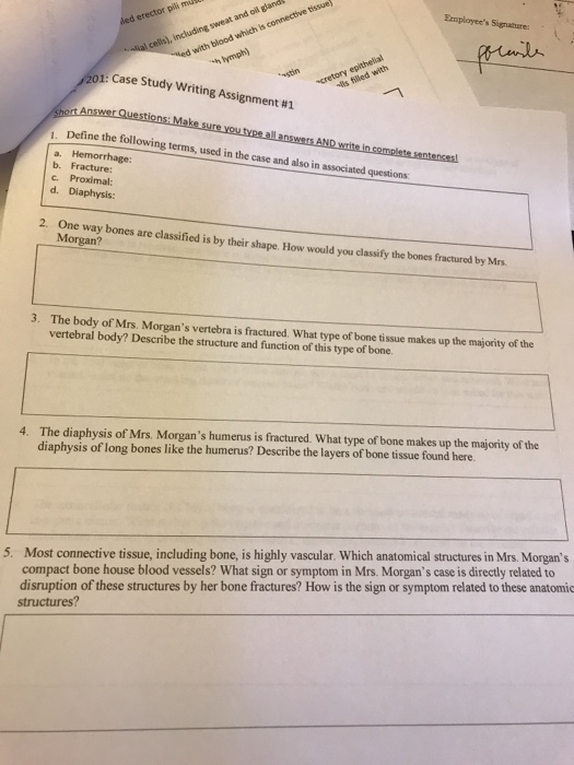 What structure(s) make up spongy bone? picture