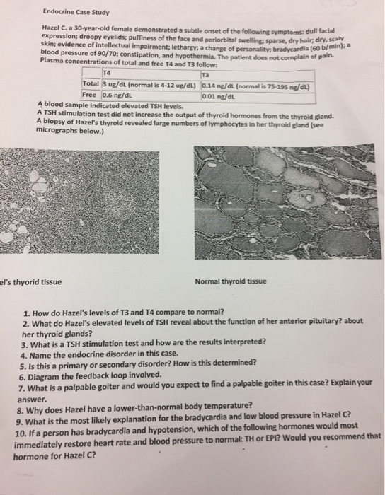 Hazel case study problems image