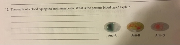 In cold blood alt-j. Fermentlarni immobillash. Alex j пианино. Alt blood. Alt blood.