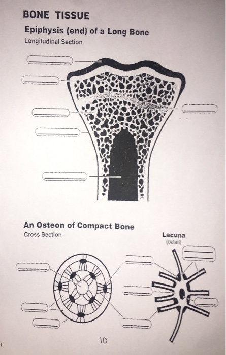 Solved: BONE TISSUE Epiphysis (end) Of A Long Bone Longitu ...