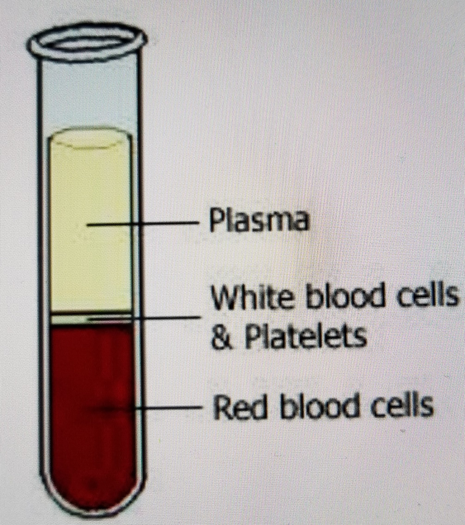 Solved : One of the most important tools in all of medical | Chegg.com, image size:907x1024