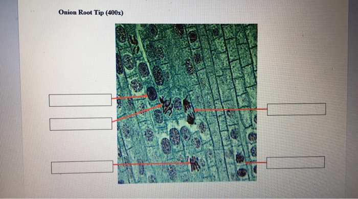 Solved: Onion Cell Pictures The Next Two Images Are Real M ... labeled diagram of an onion cell 