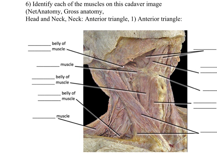 ANAT 411 Anterior View of the Muscles of Head & Neck Diagram