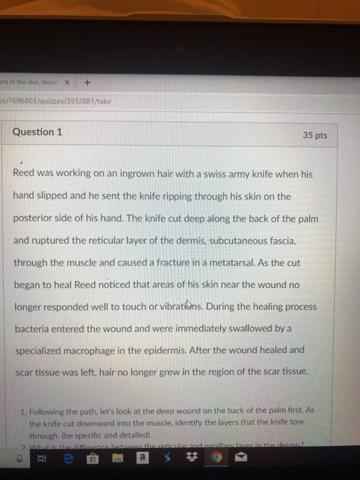 Solved Urs In The Skin Blood X Es 1696803 Quizzes 39328