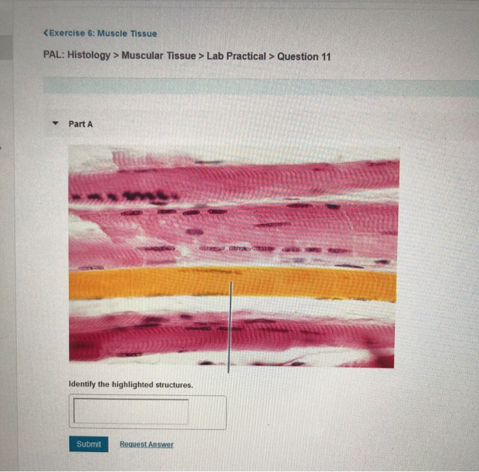 Exercise 6 Muscle Tissue Pal Histology Muscular Chegg 