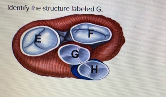 Identify the structure labeled G G