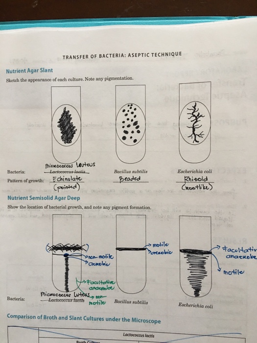 Culturing and aseptic technique lab report picture