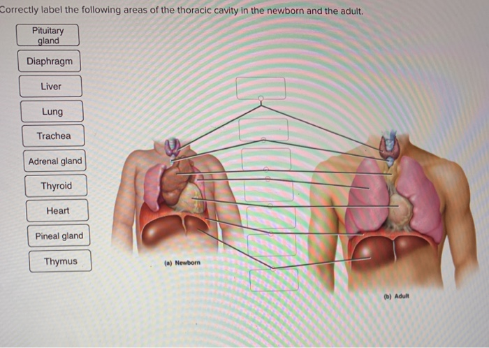 Correctly label the following area of the thoracic cavity in the newborn .....