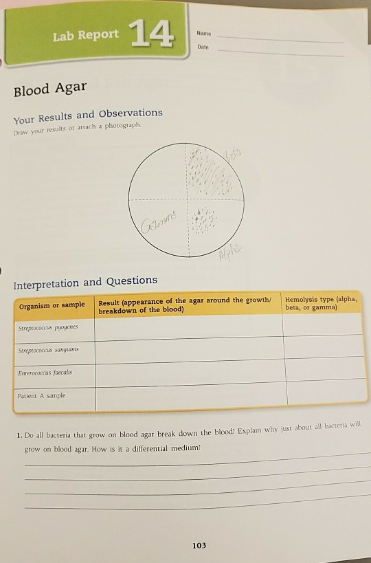 Blood Agar Lab Report