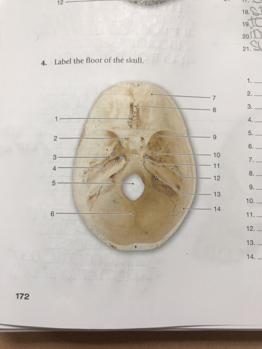 Solved 12 19 20 21 4 Label The Floor Of The Skull 2 3