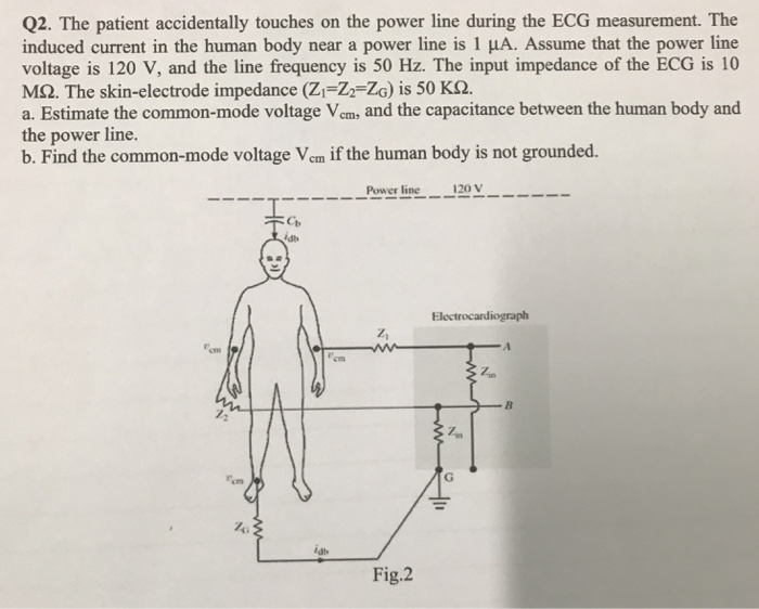 Q2. The patient accidentally touches on the power line during the ECG measurement. The induced current in the human body near a power line is 1 μA. Assume that the power line voltage is 120 V, and the line frequency is 50 Hz. The input impedance of the ECG is 10 M2. The skin-electrode impedance (Zi-Z2-ZG) is 50 K2. a. Estimate the common-mode voltage Vem, and the capacitance between the human body and the power line. b. Find the common-mode voltage Vcm if the human body is not grounded. Power ling 120V -T Z, 72 Fig.2