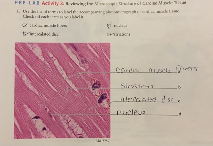 Cardiac Muscle Tissue Labeled Striations