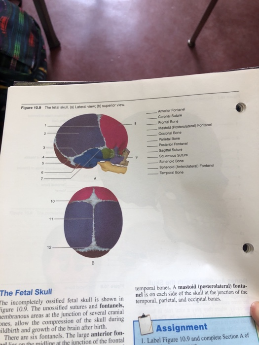 sutures of the fetal skull