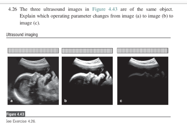 Ultrasound homework 07 image
