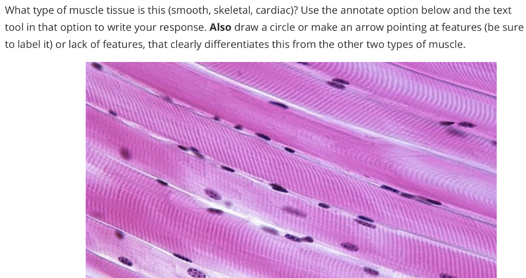 cardiac smooth and skeletal muscle