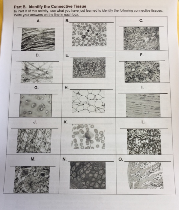 Connective tissue bone picture