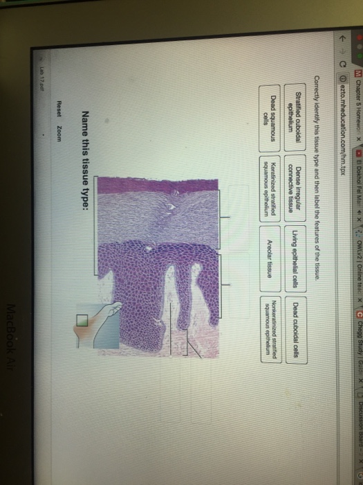 Solved: Correctly Identify This Tissues Type And Then Labe... | Chegg.com