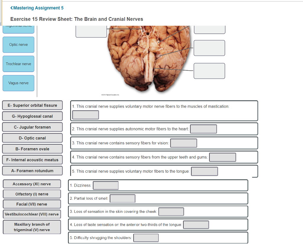Review Sheet Gross Anatomy Of The Brain And Cranial Nerves