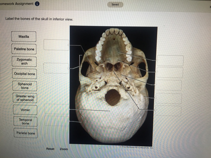 sphenoid bone inferior view