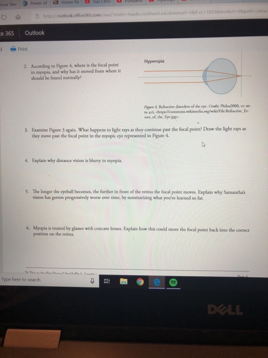 Why is pressure inside of the eye necessary for proper vision? image