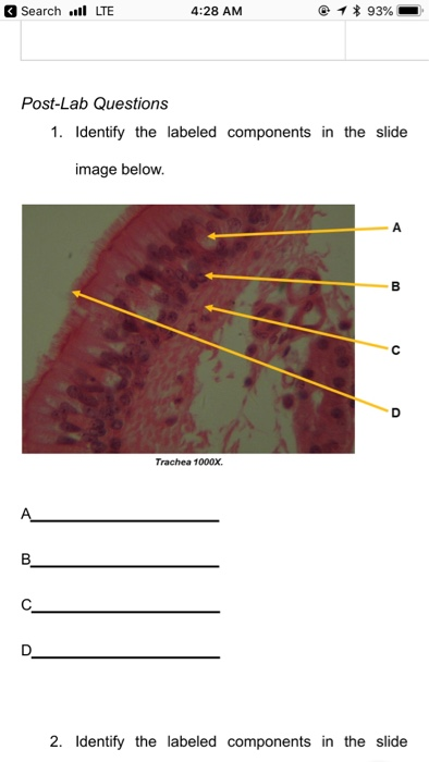 trachea slide labeled