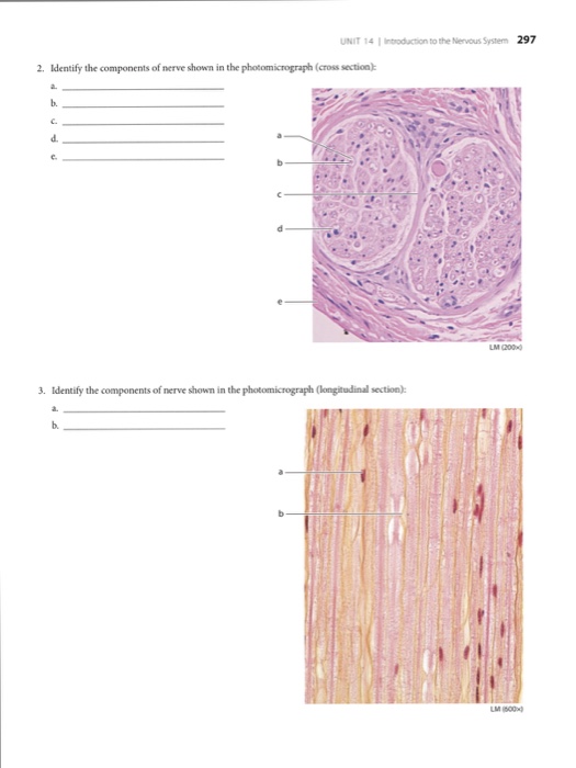 Assignable contract clause picture