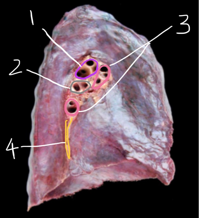 pulmonary ligament cadaver