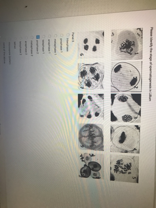 Solved Interphase Prophase 1 Metaphase 1 Telephase 1 Telo