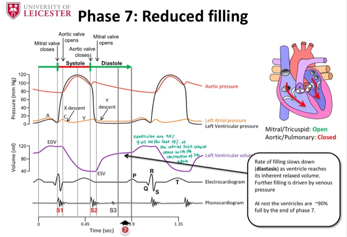 wiggers diagram aortic regurgitation