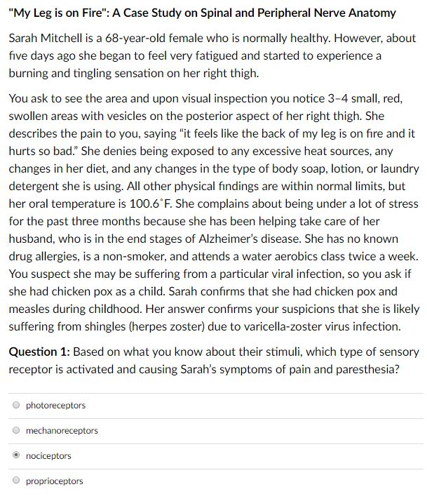 What part of a neuron is located in the dorsal root ganglion image