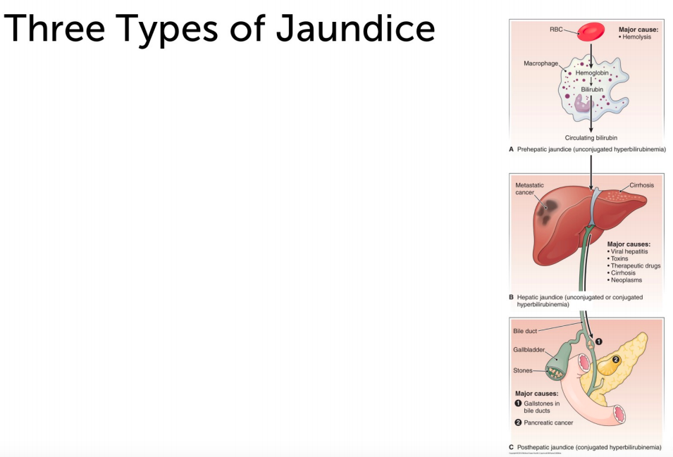 Solved: Figure 16-4 Illustrates 3 Different Types Of Jaund ...
