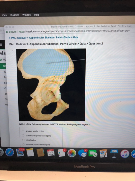 Solved Al Cadaver Appendicular Skeleton Pelvic Girdle Chegg Com