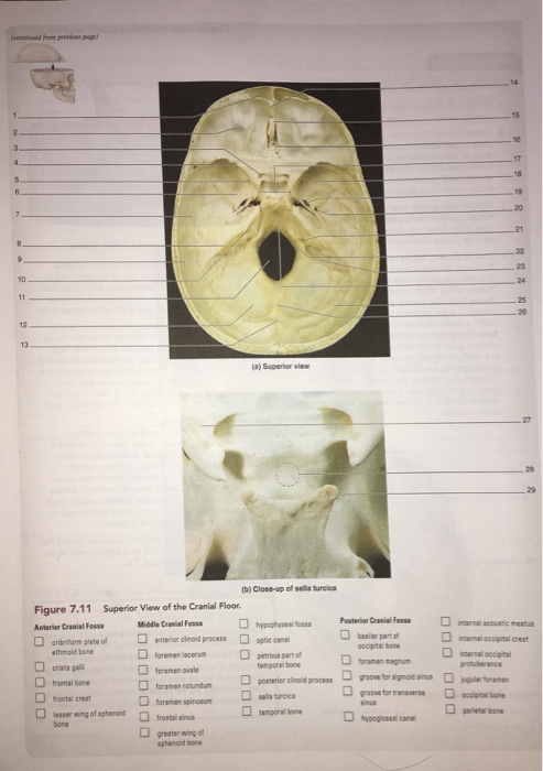 Solved A Superior View Figure 7 11 Superior View Of The