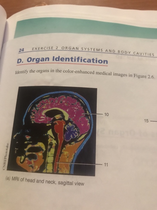 An Systems And Body Cavitles X Rcse 2 An Chegg 