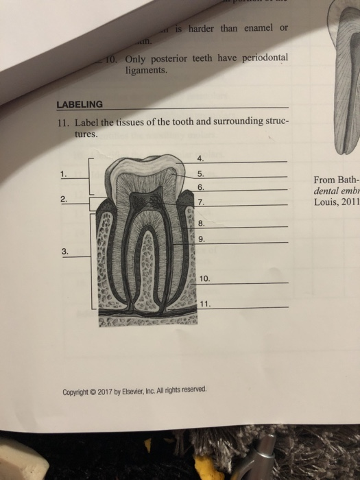Solved Is Harder Than Enamel Or 0. Only Posterior Teeth H...