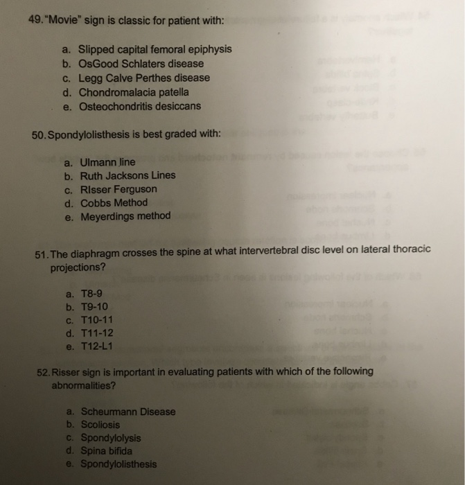 slipped capital femoral epiphysis vs legg calve perthes disease