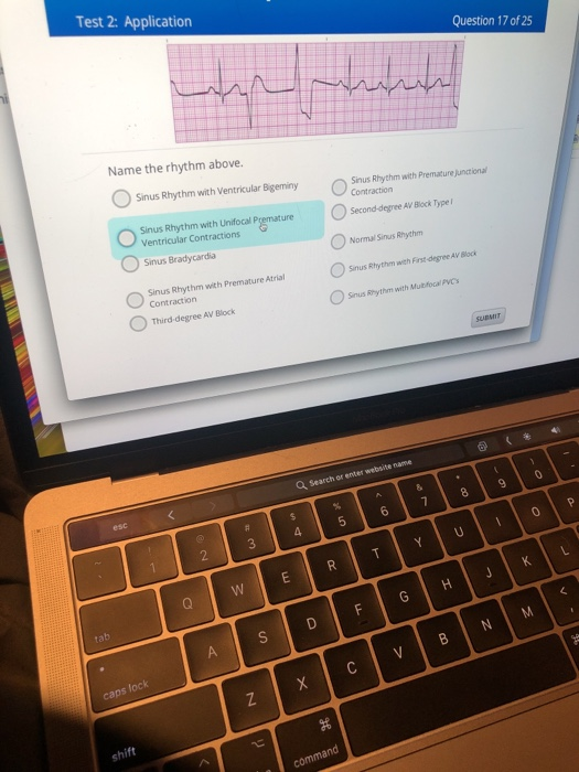 Solved Test 2 Application Question 17 Of 25 Name The Rhy Chegg Com