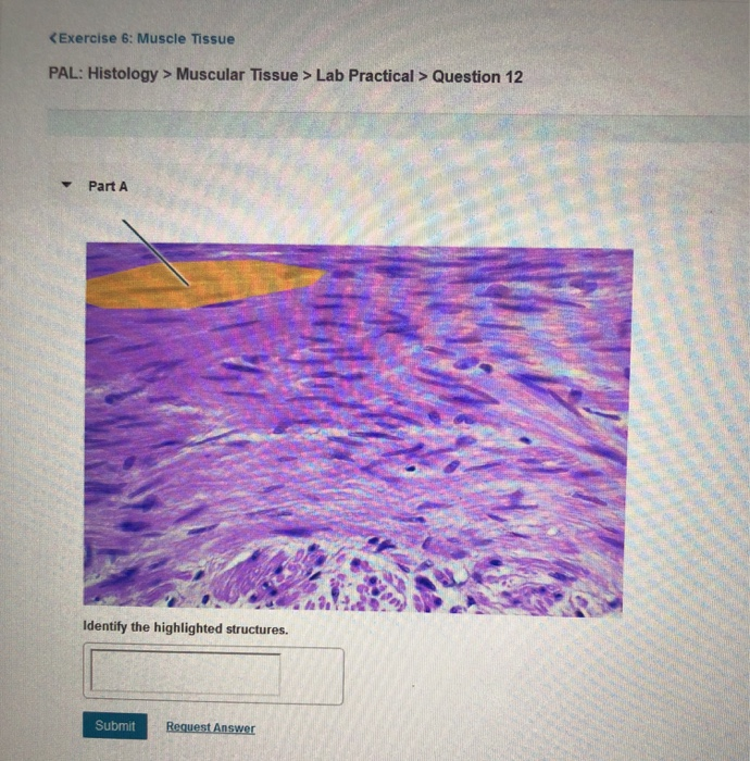 Exercise 6 Muscle Tissue Pal Histology Muscular Chegg 